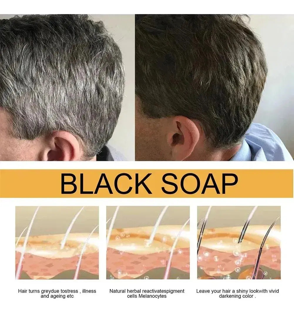 Barra de Shampoo Negro Anti Canas – Black Soap Bar Shampoo